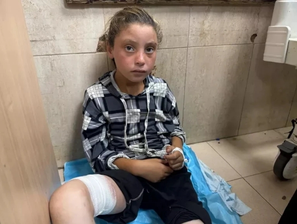 UNICEF/UNI829270/Eleyan Reema, de 10 años, sobrevivió a un ataque aéreo contra un centro de nutrición en Deir El Balah, en el que murieron 15 personas, entre ellas nueve niños y cuatro mujeres. 10 de julio de 2025.