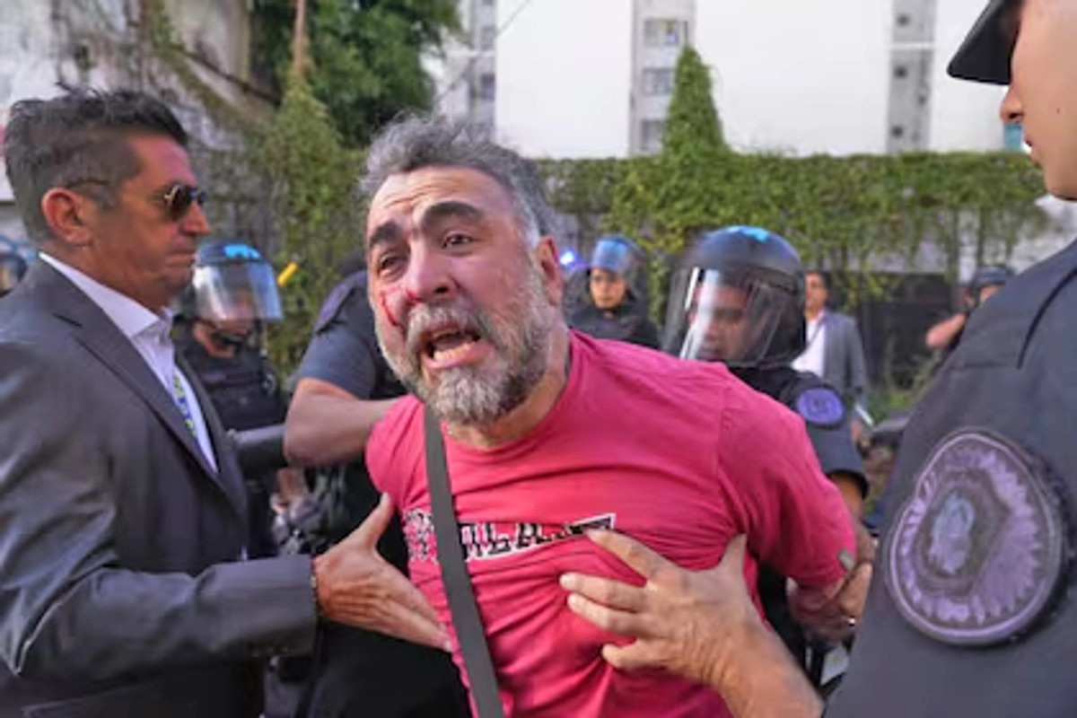La imagen del camarógrafo Facundo Tedeschini, con la cara ensangrentada y arrastrado con las manos atadas tras ser atacado por unos diez policías, evidenció la violencia contra la prensa por parte del gobierno de Javier Milei. Foto X @radiolared